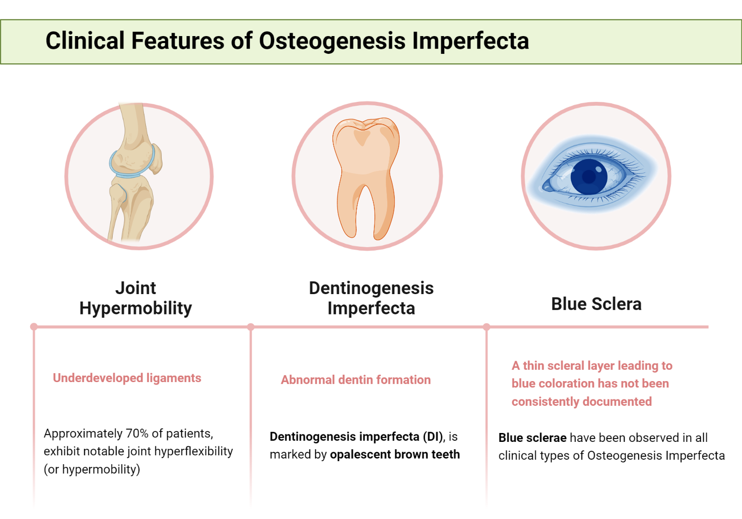 Osteogenesis Imperfecta Symptoms And Signs - My Endo Consult